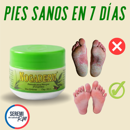 Pies Sanos en 7 días, Crema reparadora Nogaderm +🎁Guía digital de bienestar de regalo